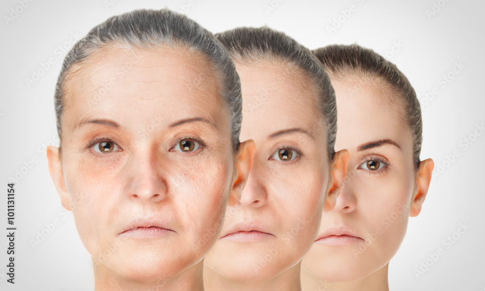 衰老过程，嫩肤抗衰老皮肤程序