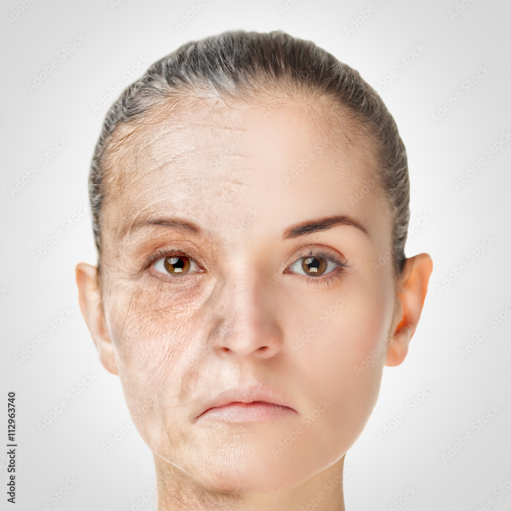 衰老过程，嫩肤抗衰老皮肤程序——老与年轻的概念