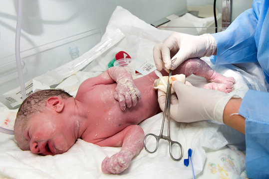 Newborn baby after birth in hospital
