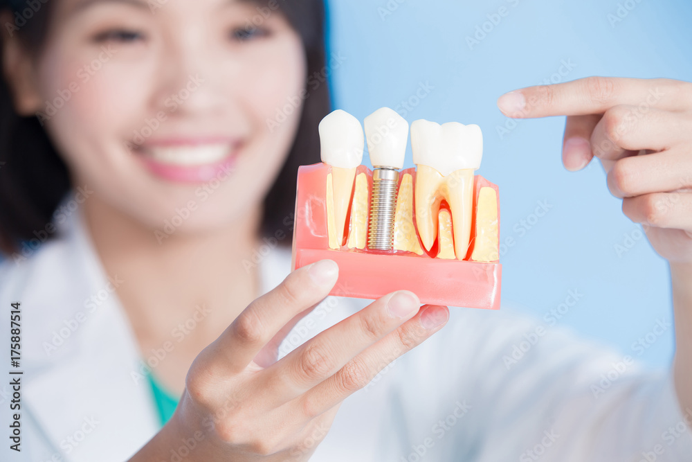 女牙医取种植牙