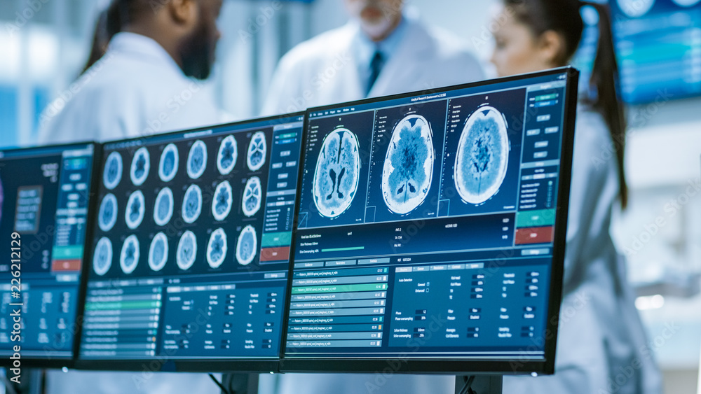 计算机屏幕显示大脑的MRI、CT图像扫描。在M团队的背景会议上
