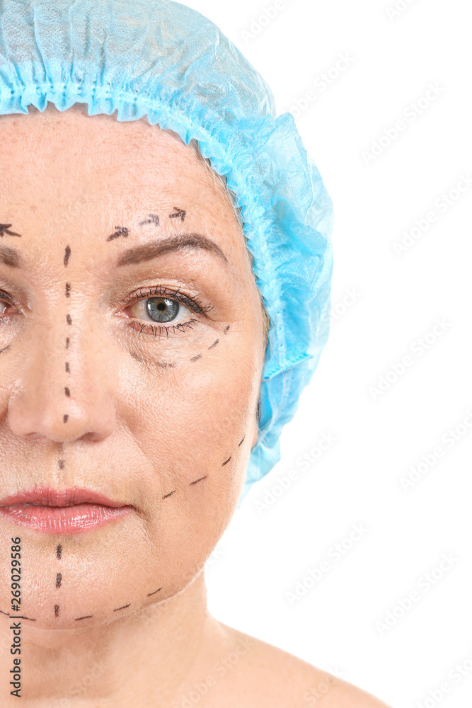 白色背景下脸上有痕迹的成熟女性，特写。整形手术的概念