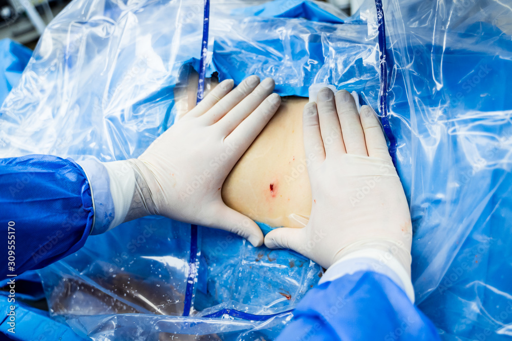 手戴手术手套在手术室，背景是手术室背景中的患者。选择