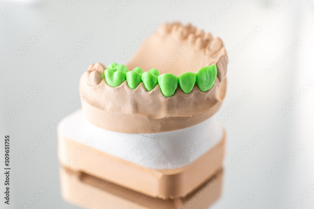 Close-up on plaster model of artificial jaw with teeth painted in green on the mirror background. Co
