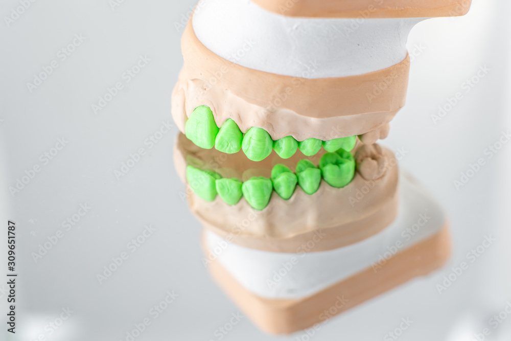 镜子背景上涂有绿色牙齿的人工颌石膏模型特写。Co