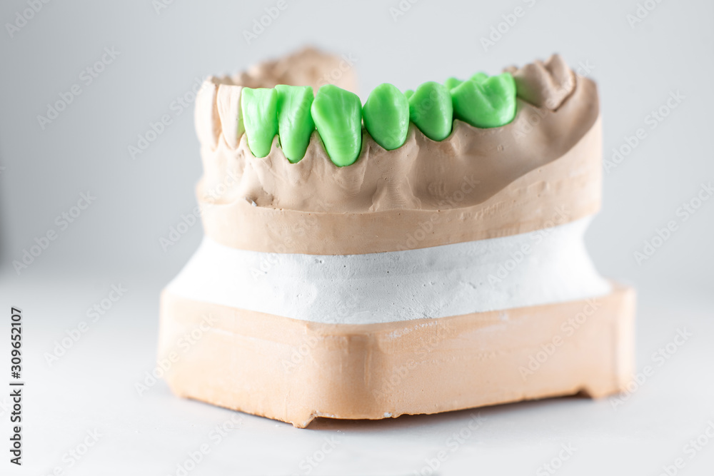 Close-up on plaster model of artificial jaw with teeth painted in green on the white background. Con
