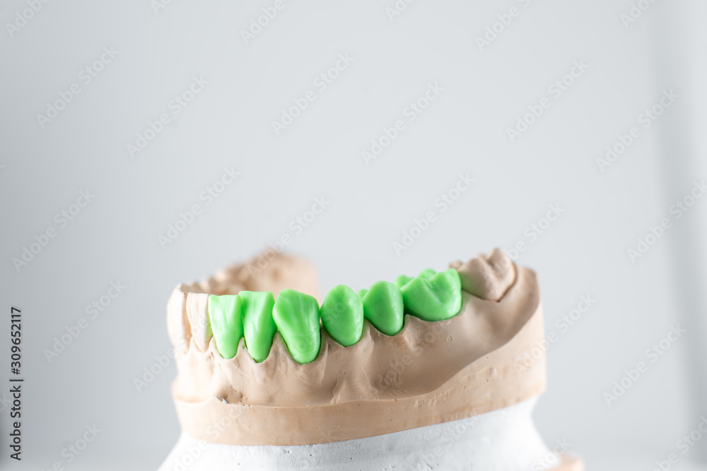 Close-up on plaster model of artificial jaw with teeth painted in green on the white background. Con