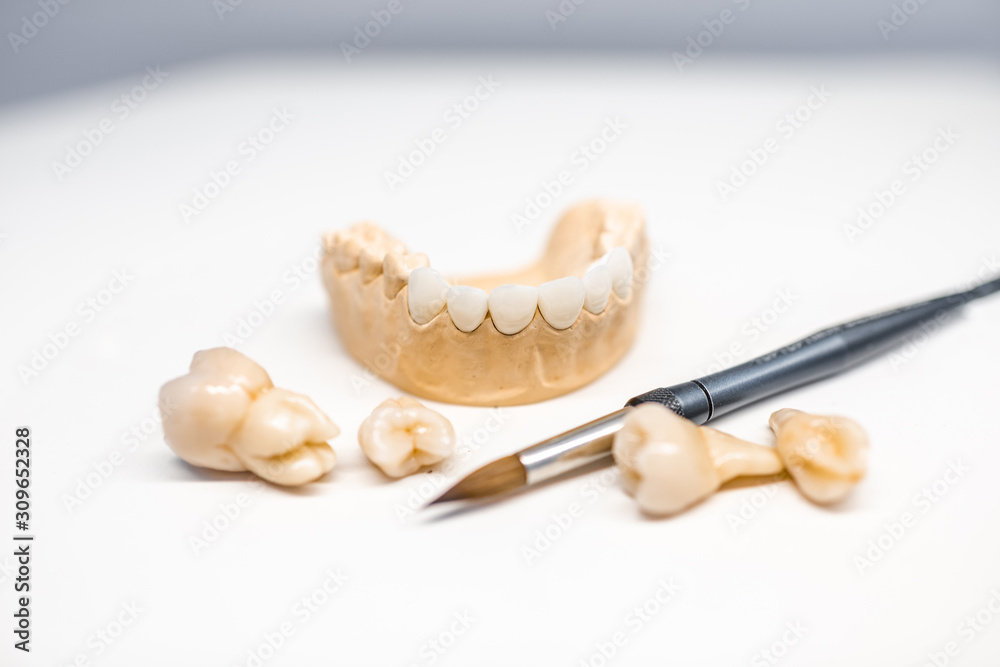 白色背景上有牙齿和画笔的人工颌石膏模型特写。Conce