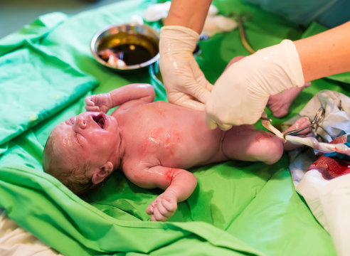 Newborn baby after birth in hospital