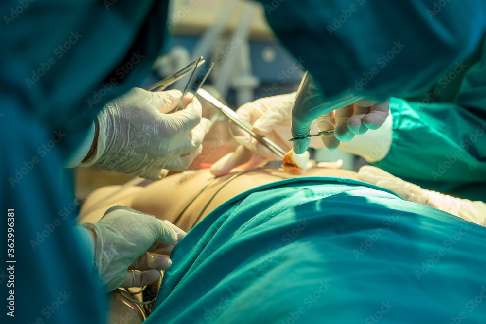 团队外科医生在手术室为病人做手术。