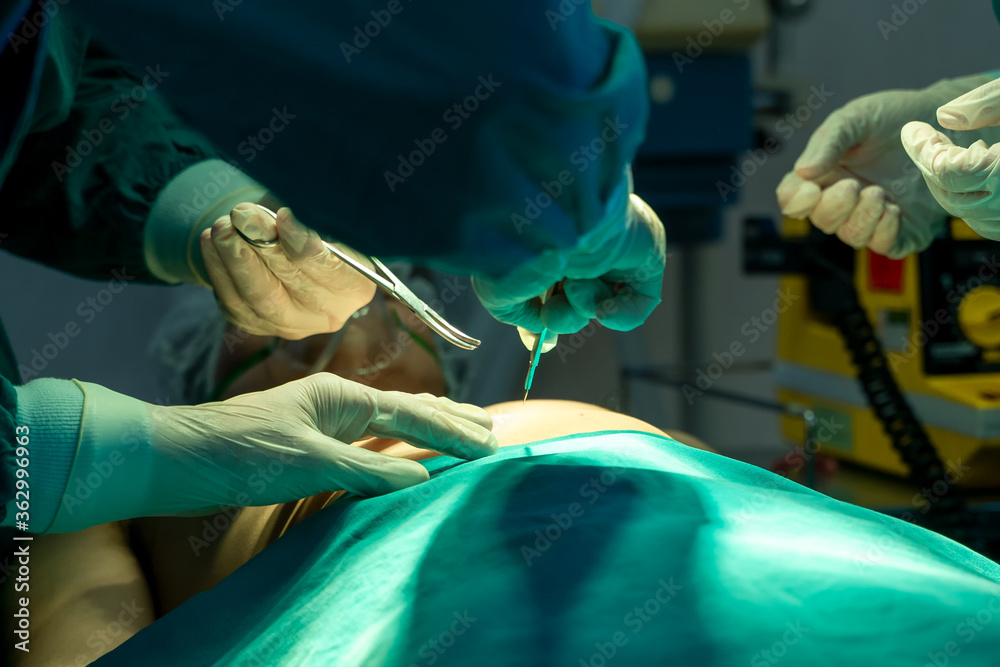 团队外科医生正在手术室为患者做手术。