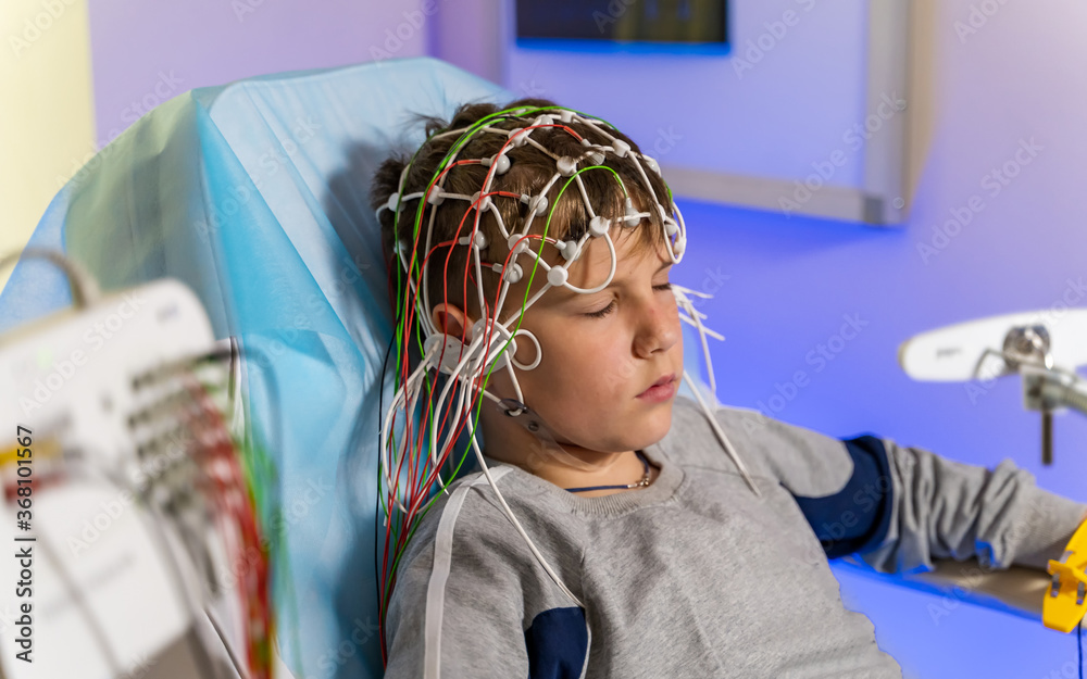 脑电图记录过程中患者的脑电图电极放置。脑电图（EEG）。