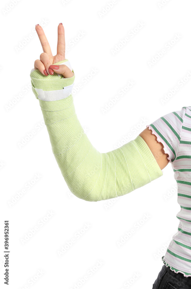 一名手臂骨折的年轻女子在白底上展示胜利手势
