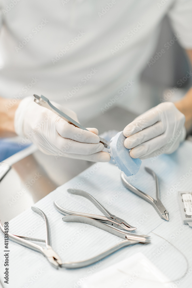 Dental technician working with a model of teeth trying on a brace system for orthodontic treatment a