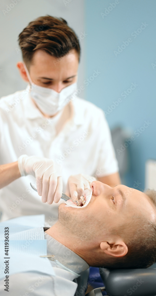 牙医在为年轻男性患者进行正畸治疗时调整牙套。4k视频sc