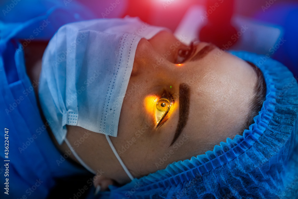 激光女性眼部矫正。激光视力矫正手术。