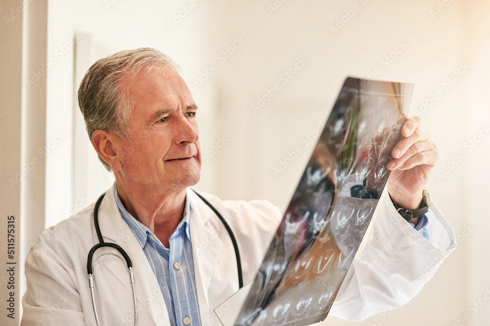 这次扫描只有好消息。一位成熟的医生举起x光片检查我的裁剪镜头