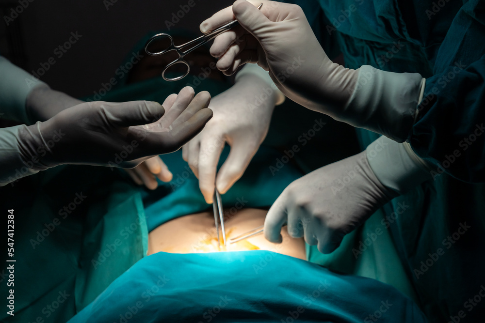 手术团队进行手术的图像，护士向外科医生分发无菌剪刀作为支持