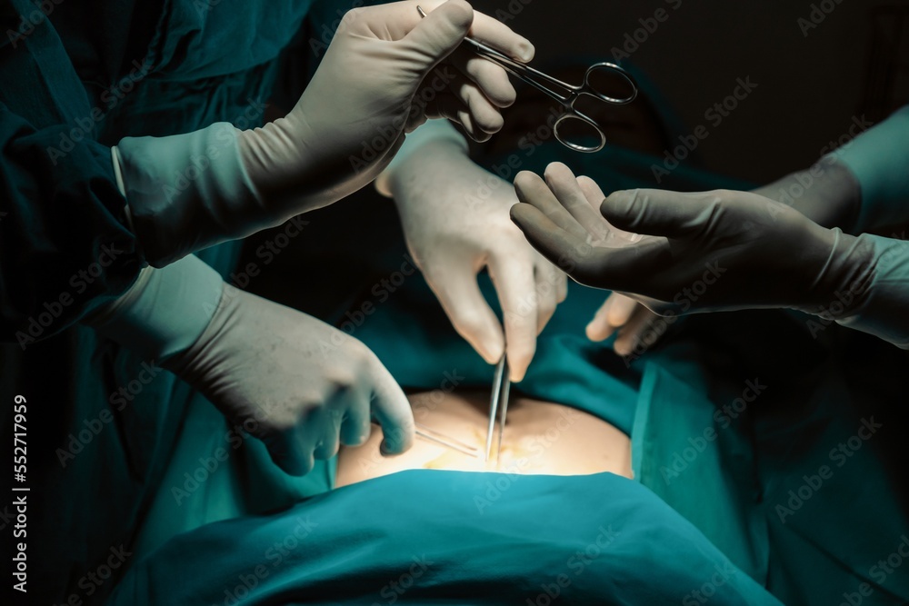 Image of surgical team perform surgery operation, nurse hand out sterile scissors to surgeon as supp